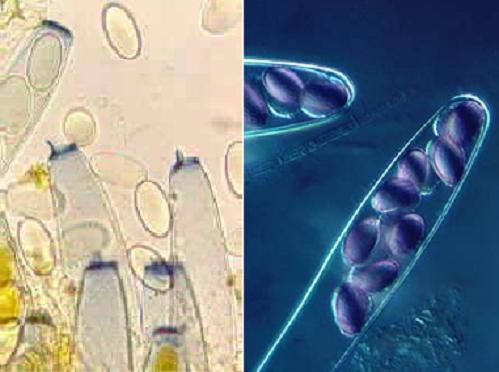 Fotos microscopio de asca unitunicada operculada  y de asca unitunicada inoperculada